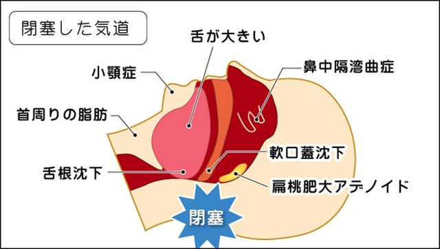 やっちまった速報(画像20222146635462_4)