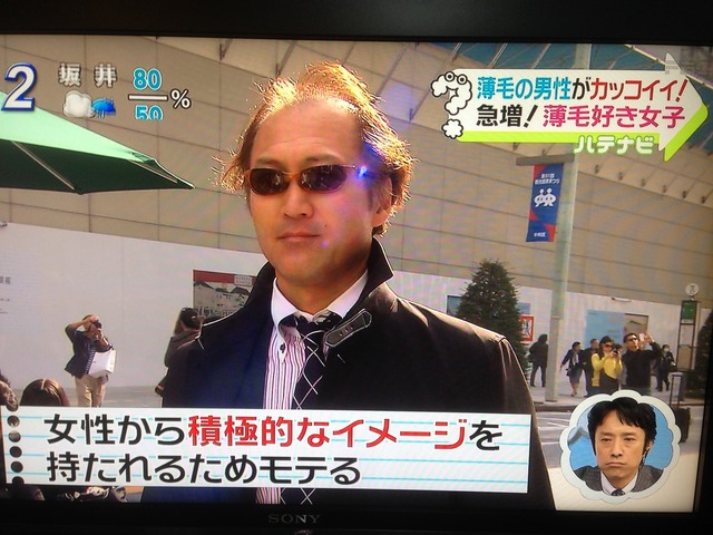 【吉報】髪の毛作る「第3の細胞」発見ッ!2026年末~毛根復活wwww | 【吉報】髪の毛作る「第3の細胞」発見ッ!2026年末~毛根復活wwww | やっちまった速報(画像26190526930481_2) 【吉報】髪の毛作る「第3の細胞」発見ッ!2026年末~毛根復活wwww | 【吉報】髪の毛作る「第3の細胞」発見ッ!2026年末~毛根復活wwww | やっちまった速報(画像26190526930481_2)