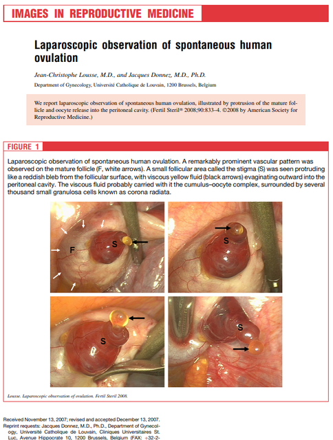 【画像】女の子の排卵シーン、あまりにもエロ過ぎるｗｗｗｗｗｗｗ | 【画像】女の子の排卵シーン、あまりにもエロ過ぎるｗｗｗｗｗｗｗ | 【画像】女の子の排卵シーン、あまりにもエロ過ぎるｗｗｗｗｗｗｗ | 【画像】女の子の排卵シーン、あまりにもエロ過ぎるｗｗｗｗｗｗｗ | やっちまった速報(画像07132220064206_4)