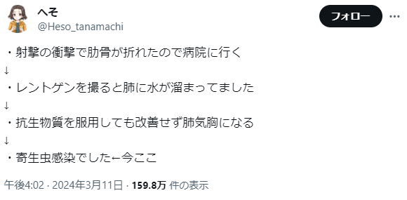 【画像】生牛丼、マジで流行るｗｗｗｗｗｗ | 【画像】生牛丼、マジで流行るｗｗｗｗｗｗ | 【画像】生牛丼、マジで流行るｗｗｗｗｗｗ | 【画像】生牛丼、マジで流行るｗｗｗｗｗｗ | 【画像】生牛丼、マジで流行るｗｗｗｗｗｗ | 【画像】生牛丼、マジで流行るｗｗｗｗｗｗ | 【画像】生牛丼、マジで流行るｗｗｗｗｗｗ | 【画像】生牛丼、マジで流行るｗｗｗｗｗｗ | 【画像】生牛丼、マジで流行るｗｗｗｗｗｗ | 【画像】生牛丼、マジで流行るｗｗｗｗｗｗ | 【画像】生牛丼、マジで流行るｗｗｗｗｗｗ | 【画像】生牛丼、マジで流行るｗｗｗｗｗｗ | やっちまった速報(画像10125525000090_12)