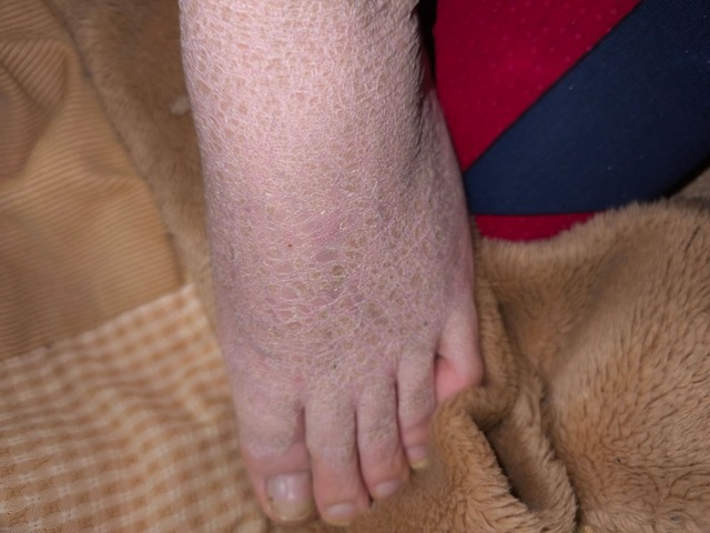 【閲覧注意】ワイの足、ガチでキモすぎると一部で話題にwwwwwwwwwwwwwww | 【閲覧注意】ワイの足、ガチでキモすぎると一部で話題にwwwwwwwwwwwwwww | 【閲覧注意】ワイの足、ガチでキモすぎると一部で話題にwwwwwwwwwwwwwww | 【閲覧注意】ワイの足、ガチでキモすぎると一部で話題にwwwwwwwwwwwwwww | 【閲覧注意】ワイの足、ガチでキモすぎると一部で話題にwwwwwwwwwwwwwww | 【閲覧注意】ワイの足、ガチでキモすぎると一部で話題にwwwwwwwwwwwwwww | やっちまった速報(画像28224426736937_6)