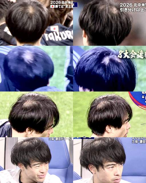 【悲報】三苫薫の“ジダン化”を投稿した海外民、日本人の悪ノリでメンタル崩壊するｗｗｗｗｗｗｗ | 【悲報】三苫薫の“ジダン化”を投稿した海外民、日本人の悪ノリでメンタル崩壊するｗｗｗｗｗｗｗ | 【悲報】三苫薫の“ジダン化”を投稿した海外民、日本人の悪ノリでメンタル崩壊するｗｗｗｗｗｗｗ | 【悲報】三苫薫の“ジダン化”を投稿した海外民、日本人の悪ノリでメンタル崩壊するｗｗｗｗｗｗｗ | 【悲報】三苫薫の“ジダン化”を投稿した海外民、日本人の悪ノリでメンタル崩壊するｗｗｗｗｗｗｗ | 【悲報】三苫薫の“ジダン化”を投稿した海外民、日本人の悪ノリでメンタル崩壊するｗｗｗｗｗｗｗ | 【悲報】三苫薫の“ジダン化”を投稿した海外民、日本人の悪ノリでメンタル崩壊するｗｗｗｗｗｗｗ | 【悲報】三苫薫の“ジダン化”を投稿した海外民、日本人の悪ノリでメンタル崩壊するｗｗｗｗｗｗｗ | 【悲報】三苫薫の“ジダン化”を投稿した海外民、日本人の悪ノリでメンタル崩壊するｗｗｗｗｗｗｗ | やっちまった速報(画像02204427856569_9)