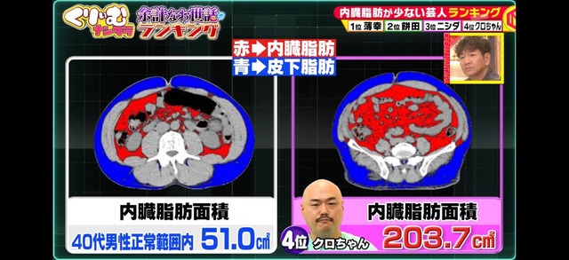 【悲報】バナナマン日村勇紀、活動休止 | 【悲報】バナナマン日村勇紀、活動休止 | 【悲報】バナナマン日村勇紀、活動休止 | 【悲報】バナナマン日村勇紀、活動休止 | 【悲報】バナナマン日村勇紀、活動休止 | やっちまった速報(画像28162527091727_5)
