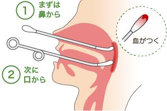 【画像】蓄膿症、顔の中がヤバイ状態になってしまう・・・・・ | 【画像】蓄膿症、顔の中がヤバイ状態になってしまう・・・・・ | 【画像】蓄膿症、顔の中がヤバイ状態になってしまう・・・・・ | 【画像】蓄膿症、顔の中がヤバイ状態になってしまう・・・・・ | 【画像】蓄膿症、顔の中がヤバイ状態になってしまう・・・・・ | 【画像】蓄膿症、顔の中がヤバイ状態になってしまう・・・・・ | 【画像】蓄膿症、顔の中がヤバイ状態になってしまう・・・・・ | 【画像】蓄膿症、顔の中がヤバイ状態になってしまう・・・・・ | 【画像】蓄膿症、顔の中がヤバイ状態になってしまう・・・・・ | 【画像】蓄膿症、顔の中がヤバイ状態になってしまう・・・・・ | やっちまった速報(画像02031747566641_10)