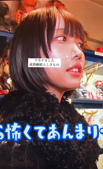 【悲報】あのちゃん（29）、干されはじめる。各テレビ局がキャスティング予定の番組を見合わせる | 【悲報】あのちゃん（29）、干されはじめる。各テレビ局がキャスティング予定の番組を見合わせる | 【悲報】あのちゃん（29）、干されはじめる。各テレビ局がキャスティング予定の番組を見合わせる | 【悲報】あのちゃん（29）、干されはじめる。各テレビ局がキャスティング予定の番組を見合わせる | 【悲報】あのちゃん（29）、干されはじめる。各テレビ局がキャスティング予定の番組を見合わせる | 【悲報】あのちゃん（29）、干されはじめる。各テレビ局がキャスティング予定の番組を見合わせる | 【悲報】あのちゃん（29）、干されはじめる。各テレビ局がキャスティング予定の番組を見合わせる | 【悲報】あのちゃん（29）、干されはじめる。各テレビ局がキャスティング予定の番組を見合わせる | 【悲報】あのちゃん（29）、干されはじめる。各テレビ局がキャスティング予定の番組を見合わせる | 【悲報】あのちゃん（29）、干されはじめる。各テレビ局がキャスティング予定の番組を見合わせる | やっちまった速報(画像29010842483042_10)