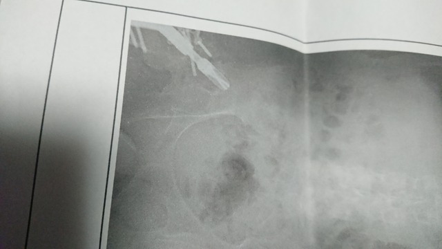 元気過ぎる88歳の認知症母親に疲れた… | 元気過ぎる88歳の認知症母親に疲れた… | やっちまった速報(画像23011853143193_2)
