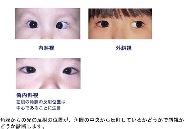 【画像】地雷系女子「これって斜視だよね？」→結果wwwwwwwwwww | 【画像】地雷系女子「これって斜視だよね？」→結果wwwwwwwwwww | 【画像】地雷系女子「これって斜視だよね？」→結果wwwwwwwwwww | 【画像】地雷系女子「これって斜視だよね？」→結果wwwwwwwwwww | やっちまった速報(画像06060509307193_4)