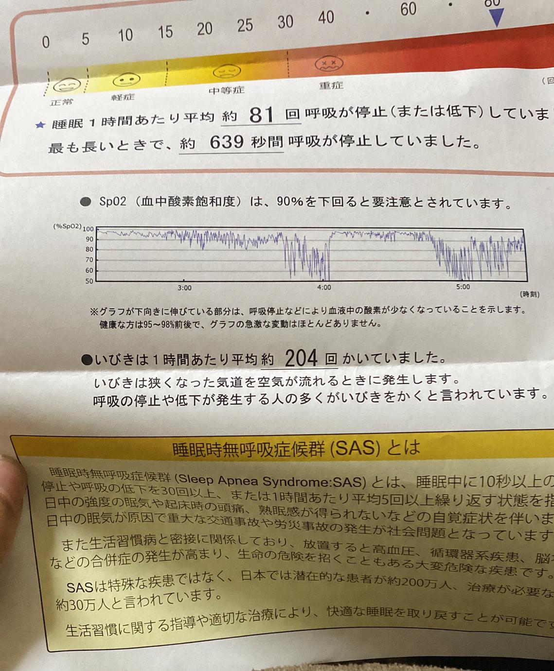 【衝撃】睡眠中のワイ、普通に死んでいた | 【衝撃】睡眠中のワイ、普通に死んでいた | やっちまった速報(11120048366454_2)