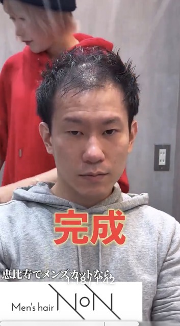 【画像】薄毛男性「センターパートにできますか？」美容師「はい、できますよ」 | 【画像】薄毛男性「センターパートにできますか？」美容師「はい、できますよ」 | 【画像】薄毛男性「センターパートにできますか？」美容師「はい、できますよ」 | 【画像】薄毛男性「センターパートにできますか？」美容師「はい、できますよ」 | 【画像】薄毛男性「センターパートにできますか？」美容師「はい、できますよ」 | 【画像】薄毛男性「センターパートにできますか？」美容師「はい、できますよ」 | 【画像】薄毛男性「センターパートにできますか？」美容師「はい、できますよ」 | 【画像】薄毛男性「センターパートにできますか？」美容師「はい、できますよ」 | 【画像】薄毛男性「センターパートにできますか？」美容師「はい、できますよ」 | 【画像】薄毛男性「センターパートにできますか？」美容師「はい、できますよ」 | やっちまった速報(20125456737359_10)