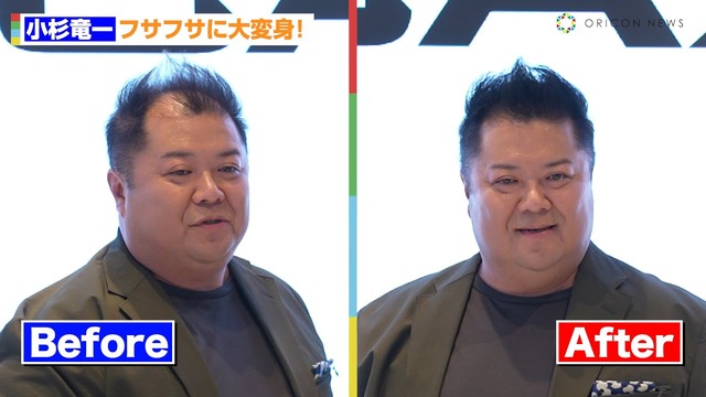 【画像】薄毛男性「センターパートにできますか？」美容師「はい、できますよ」 | 【画像】薄毛男性「センターパートにできますか？」美容師「はい、できますよ」 | 【画像】薄毛男性「センターパートにできますか？」美容師「はい、できますよ」 | 【画像】薄毛男性「センターパートにできますか？」美容師「はい、できますよ」 | 【画像】薄毛男性「センターパートにできますか？」美容師「はい、できますよ」 | 【画像】薄毛男性「センターパートにできますか？」美容師「はい、できますよ」 | 【画像】薄毛男性「センターパートにできますか？」美容師「はい、できますよ」 | 【画像】薄毛男性「センターパートにできますか？」美容師「はい、できますよ」 | 【画像】薄毛男性「センターパートにできますか？」美容師「はい、できますよ」 | 【画像】薄毛男性「センターパートにできますか？」美容師「はい、できますよ」 | 【画像】薄毛男性「センターパートにできますか？」美容師「はい、できますよ」 | 【画像】薄毛男性「センターパートにできますか？」美容師「はい、できますよ」 | 【画像】薄毛男性「センターパートにできますか？」美容師「はい、できますよ」 | やっちまった速報(20125458008010_13)