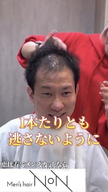 【画像】薄毛男性「センターパートにできますか？」美容師「はい、できますよ」 | 【画像】薄毛男性「センターパートにできますか？」美容師「はい、できますよ」 | 【画像】薄毛男性「センターパートにできますか？」美容師「はい、できますよ」 | 【画像】薄毛男性「センターパートにできますか？」美容師「はい、できますよ」 | 【画像】薄毛男性「センターパートにできますか？」美容師「はい、できますよ」 | 【画像】薄毛男性「センターパートにできますか？」美容師「はい、できますよ」 | 【画像】薄毛男性「センターパートにできますか？」美容師「はい、できますよ」 | やっちまった速報(20125455127179_7)