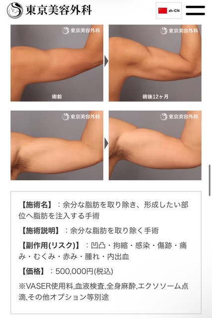 【画像】男の「筋肉整形」大ブームの兆しｗｗｗｗｗ | 【画像】男の「筋肉整形」大ブームの兆しｗｗｗｗｗ | 【画像】男の「筋肉整形」大ブームの兆しｗｗｗｗｗ | 【画像】男の「筋肉整形」大ブームの兆しｗｗｗｗｗ | 【画像】男の「筋肉整形」大ブームの兆しｗｗｗｗｗ | 【画像】男の「筋肉整形」大ブームの兆しｗｗｗｗｗ | 【画像】男の「筋肉整形」大ブームの兆しｗｗｗｗｗ | 【画像】男の「筋肉整形」大ブームの兆しｗｗｗｗｗ | やっちまった速報(23105507834603_8)